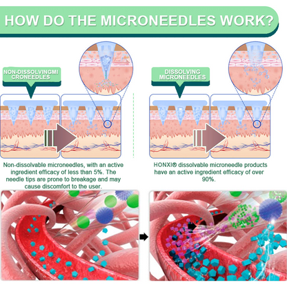 Honxi® Slimming & health NANO MICRONEEDLE PATCH 👩‍⚕️Suitable for obesity, cardiovascular diseases, diabetes, sleep apnea, high cholesterol and blood lipids, joint problems, and various other conditions