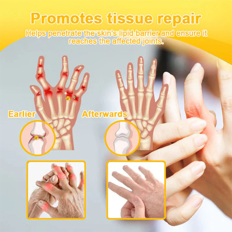 LOTMAY® Joint Freedom Formula Cream – 9-in-1 Natural Formula (FDA-Certified & Recommended) Free Shipping