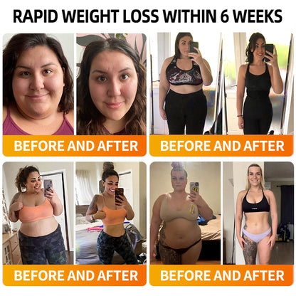 [Free Shipping]🔔RAINDEW®  SM-GLP-1 Slim & Skin Tightening Nano Cream（Painless, long-lasting, addressing diabetes, obesity, and cardiovascular diseases）💚