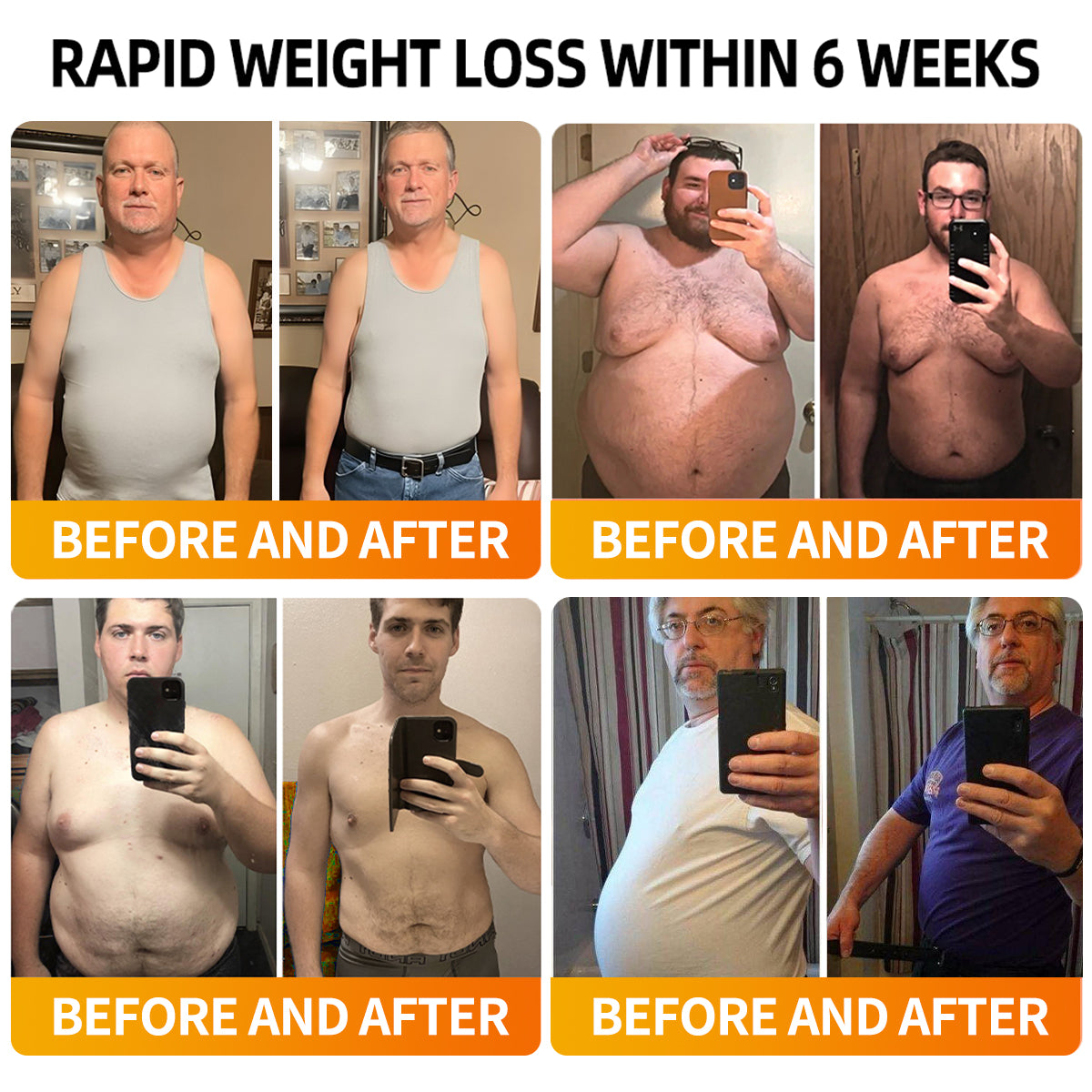 [Free Shipping]🔔RAINDEW®  SM-GLP-1 Slim & Skin Tightening Nano Cream（Painless, long-lasting, addressing diabetes, obesity, and cardiovascular diseases）💚