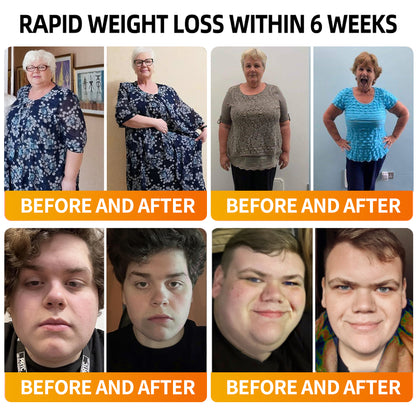 [Free Shipping]🔔RAINDEW®  SM-GLP-1 Slim & Skin Tightening Nano Cream（Painless, long-lasting, addressing diabetes, obesity, and cardiovascular diseases）💚