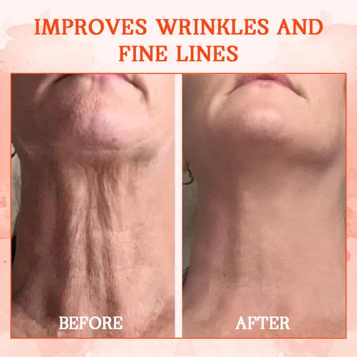 🔥 LAST DAY 80% OFF 💎𝗖𝗼𝗼𝗹𝗼𝗿𝗱®𝗟𝘂𝘅𝗲𝗟𝗶𝗳𝘁 𝗕𝗼𝗱𝘆 𝗙𝗶𝗿𝗺𝗶𝗻𝗴 𝗦𝗲𝗿𝘂𝗺