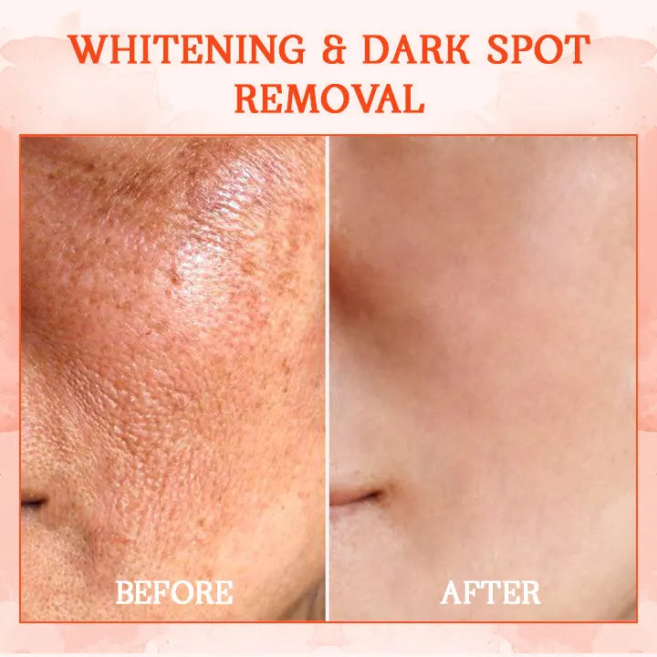 🔥 LAST DAY 80% OFF 💎𝗖𝗼𝗼𝗹𝗼𝗿𝗱®𝗟𝘂𝘅𝗲𝗟𝗶𝗳𝘁 𝗕𝗼𝗱𝘆 𝗙𝗶𝗿𝗺𝗶𝗻𝗴 𝗦𝗲𝗿𝘂𝗺
