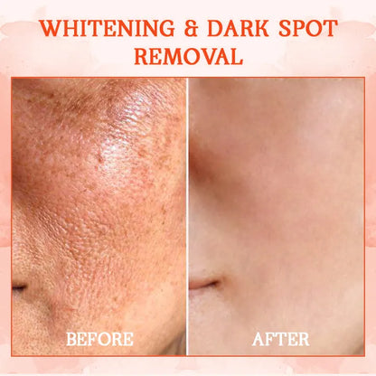 🔥 LAST DAY 80% OFF 💎𝗖𝗼𝗼𝗹𝗼𝗿𝗱®𝗟𝘂𝘅𝗲𝗟𝗶𝗳𝘁 𝗕𝗼𝗱𝘆 𝗙𝗶𝗿𝗺𝗶𝗻𝗴 𝗦𝗲𝗿𝘂𝗺