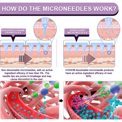 💎 HONXI® GLP-1 Nano Microneedle Patch — Slim Down, Feel Healthier, Live Freely